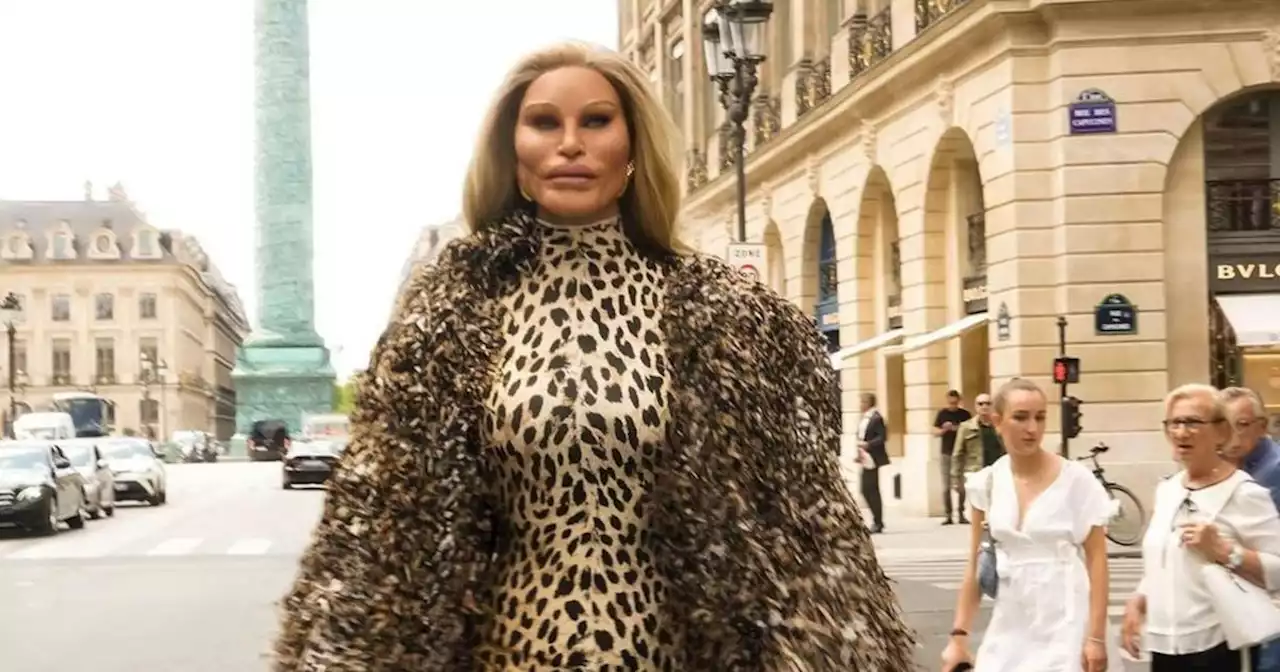 De Kate Moss à la «femme chat» : Alexis Stone, le sosie des stars, qui fascine la Fashion Week