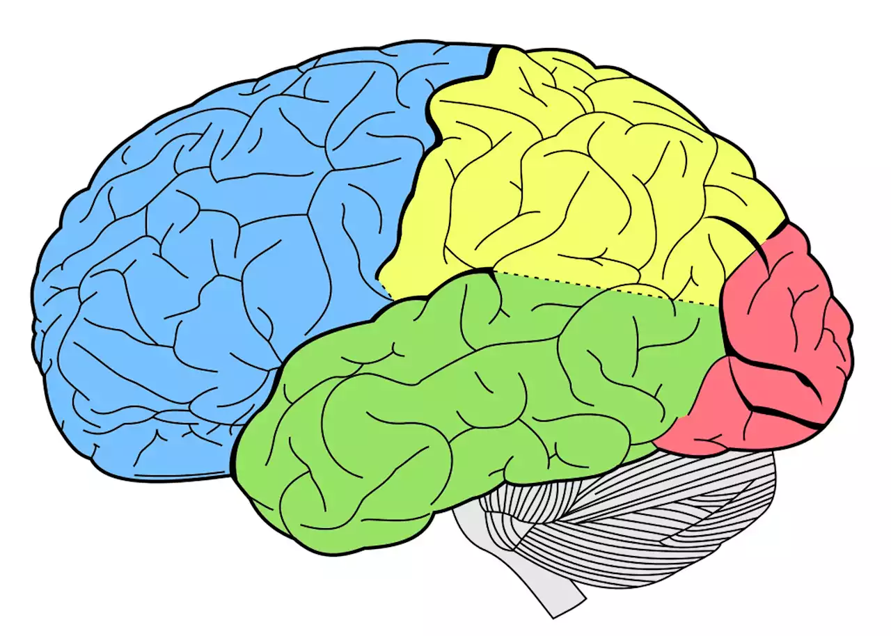 'Usual suspect' brain lesions appear not to cause most severe disability in MS patients