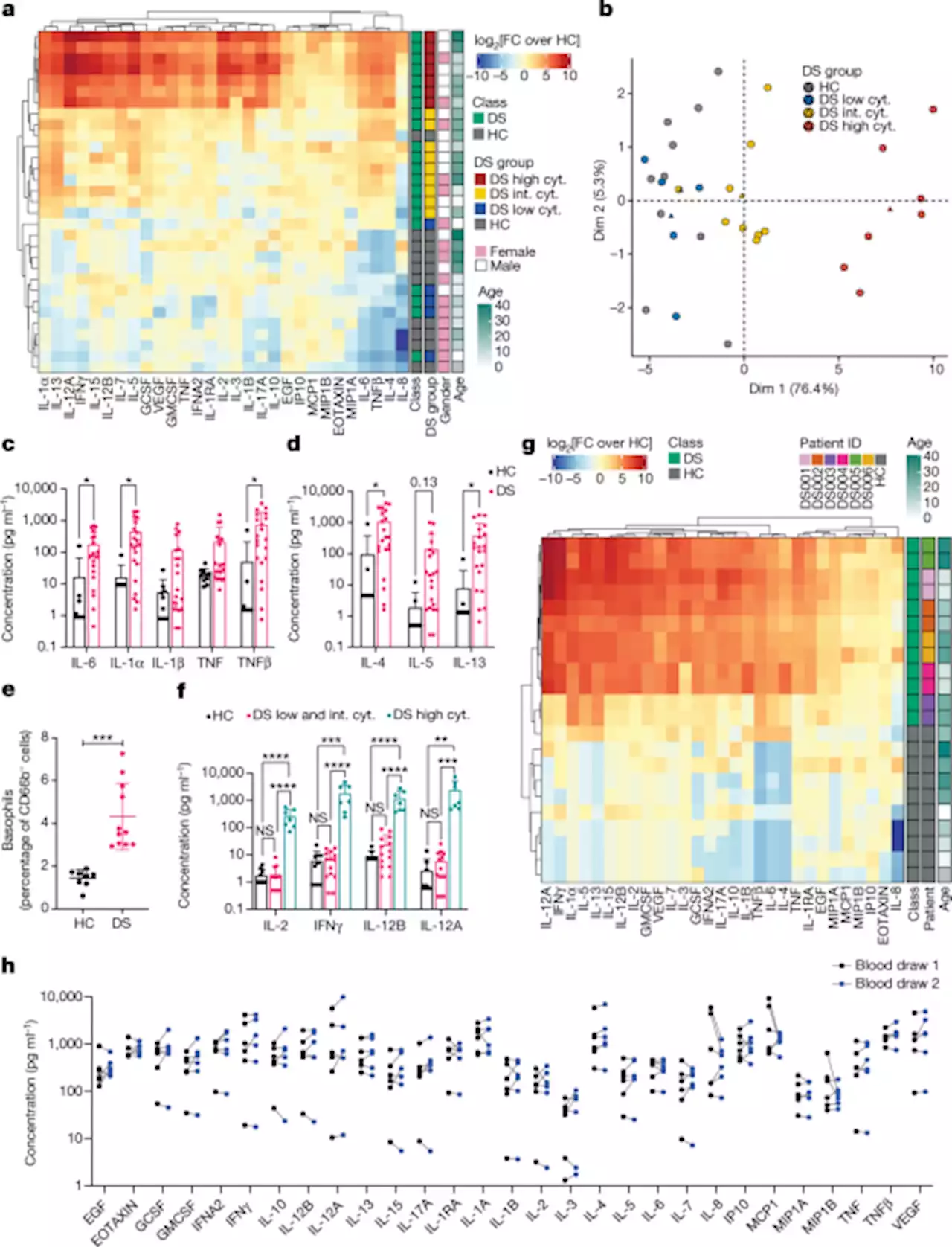 Autoimmunity in Down’s syndrome via cytokines, CD4 T cells and CD11c+ B cells - Nature