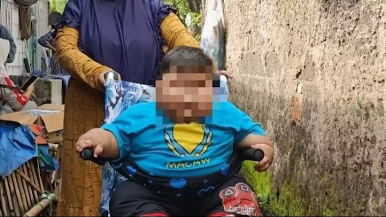 Pemkab Bekasi akan Beri Bantuan Logistik untuk Balita Obesitas, Kirim Popok Bayi Ukuran XXXL