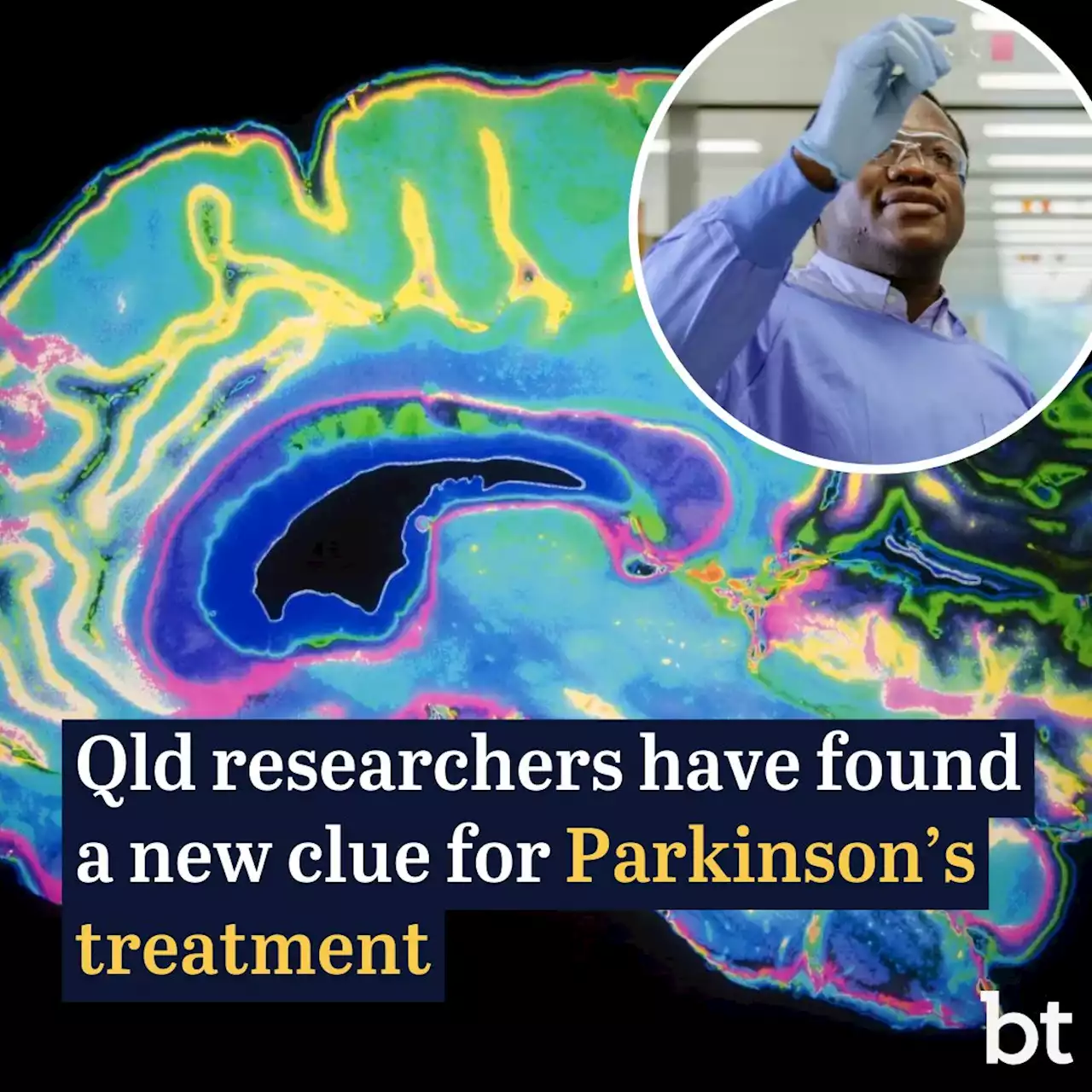 Breaking brain’s ‘recycling machine’ gives clue to Parkinson’s treatment