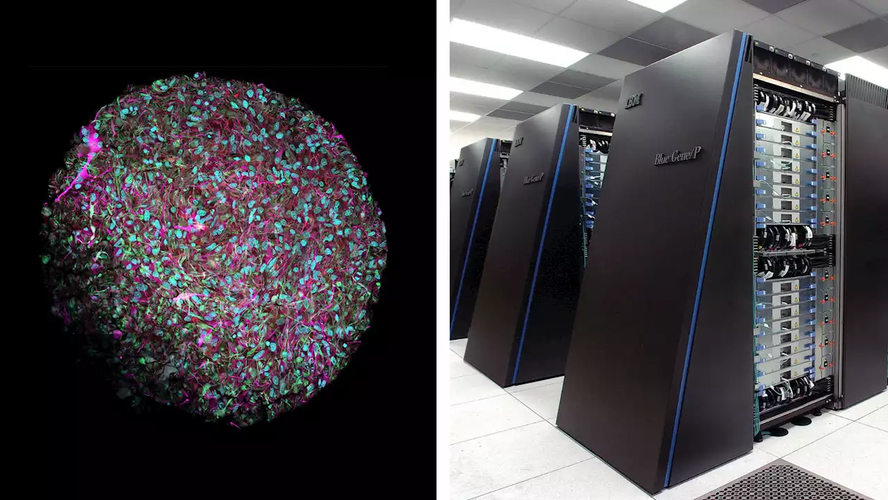 Researchers plan supercomputers that are powered by human brain cells