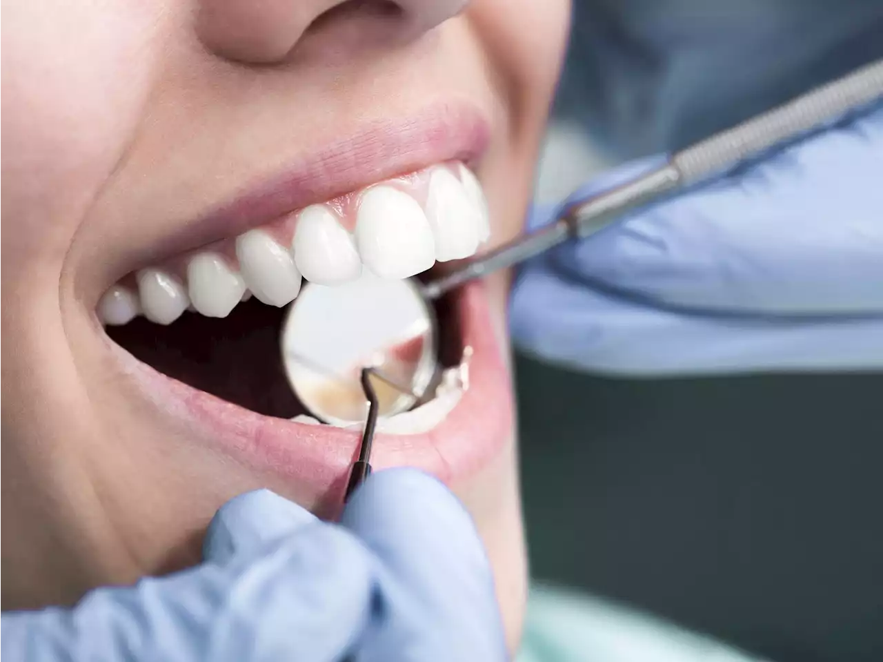 Canadian Dental Association releases recommendations for feds on dental care