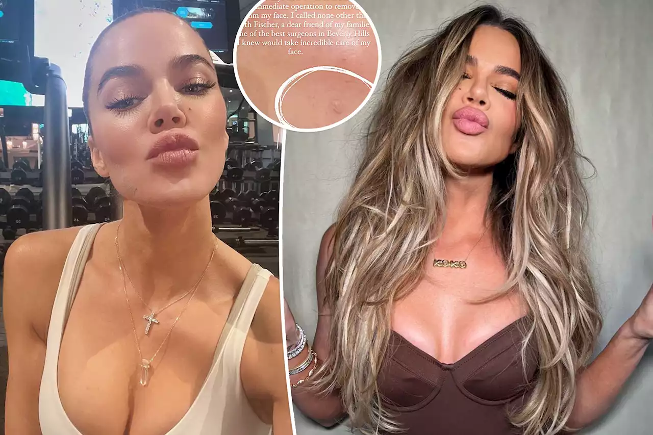 Khloé Kardashian hits back at fan who questioned her face bandage