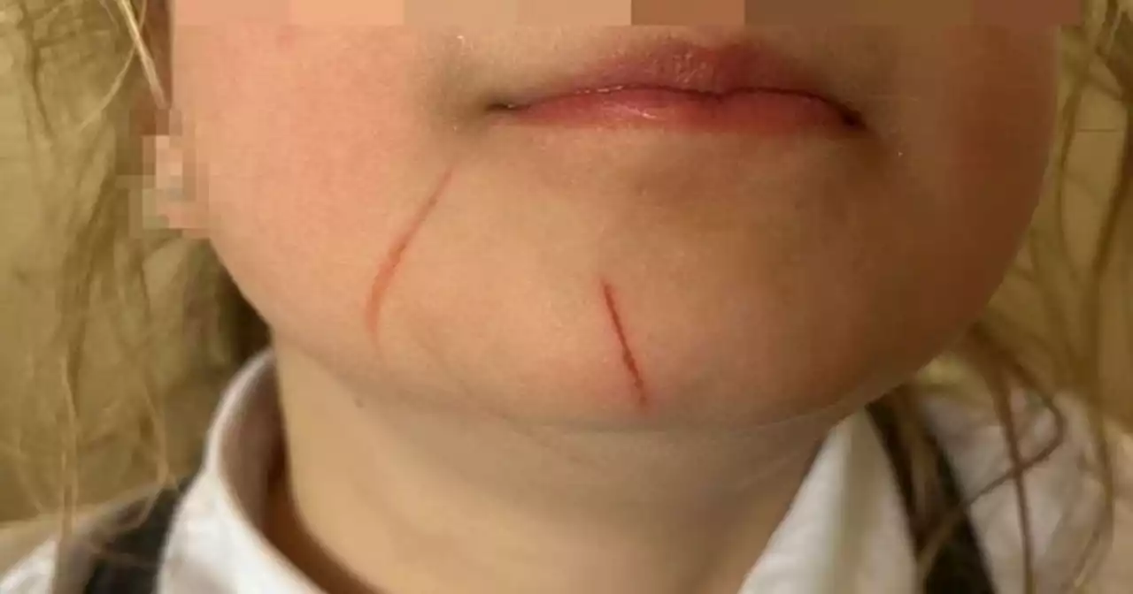 Scots mum says young daughter 'strangled and attacked' by school bullies