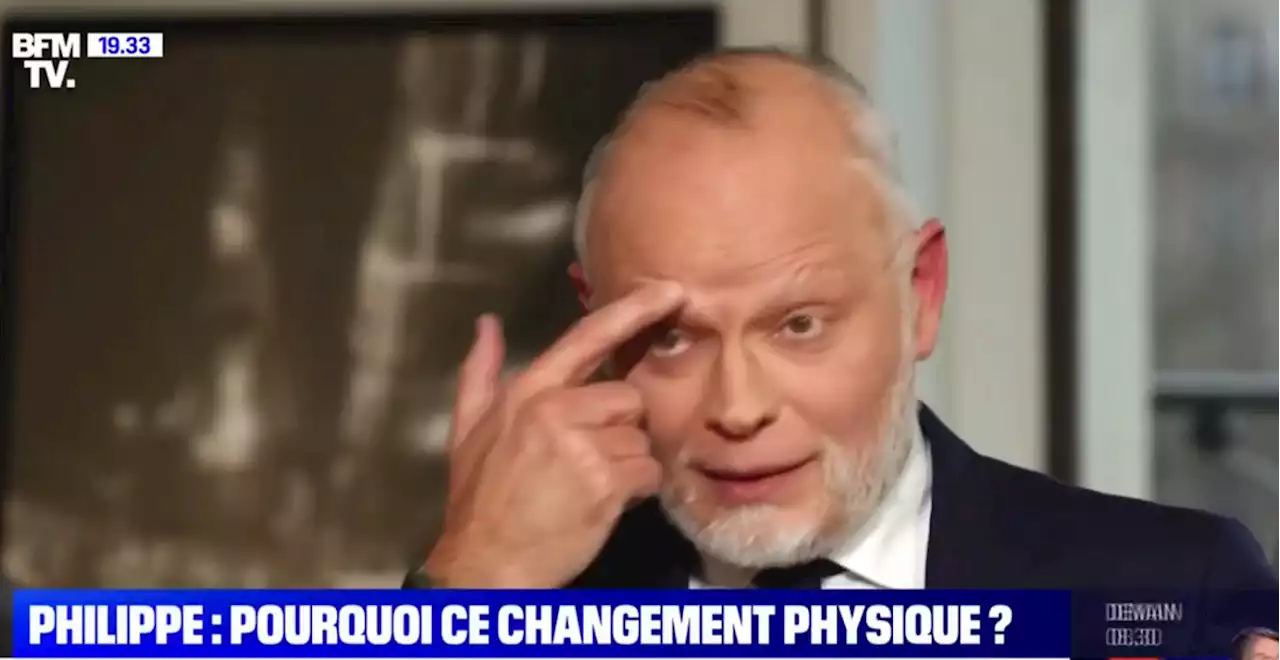 «Ni dangereux, ni contagieux» : Philippe fait la «transparence» sur son alopécie, maladie qui ne l'«empêche pas d'être ambitieux»