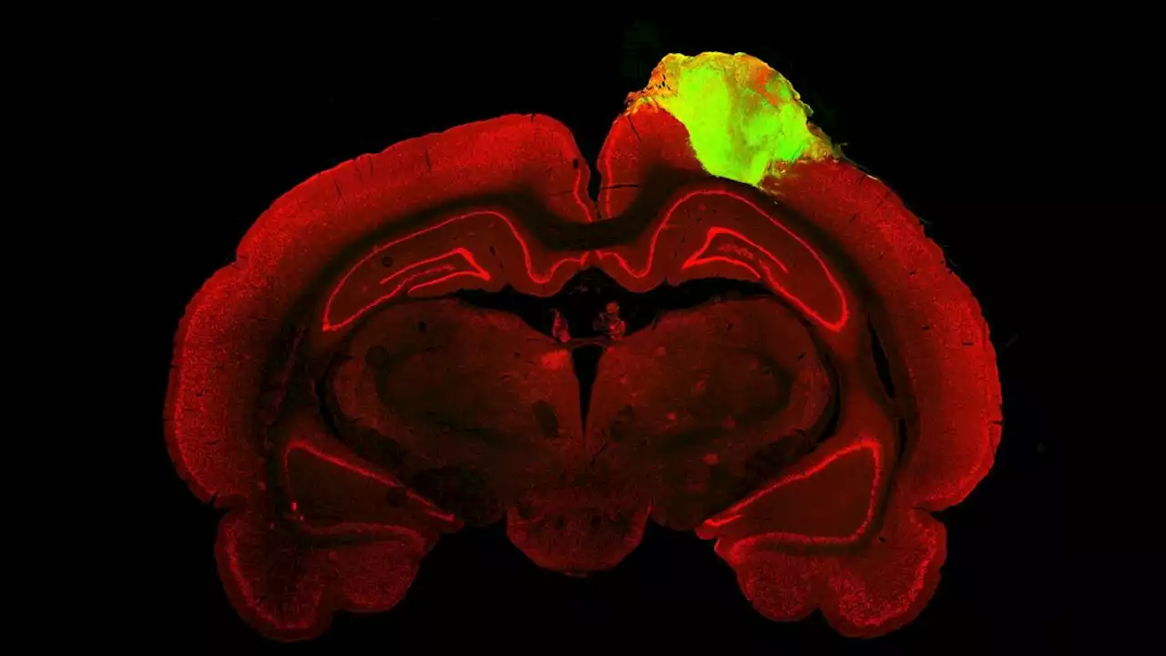 Rat brain injuries 'plugged' with lab-grown human minibrains in world-first experiment