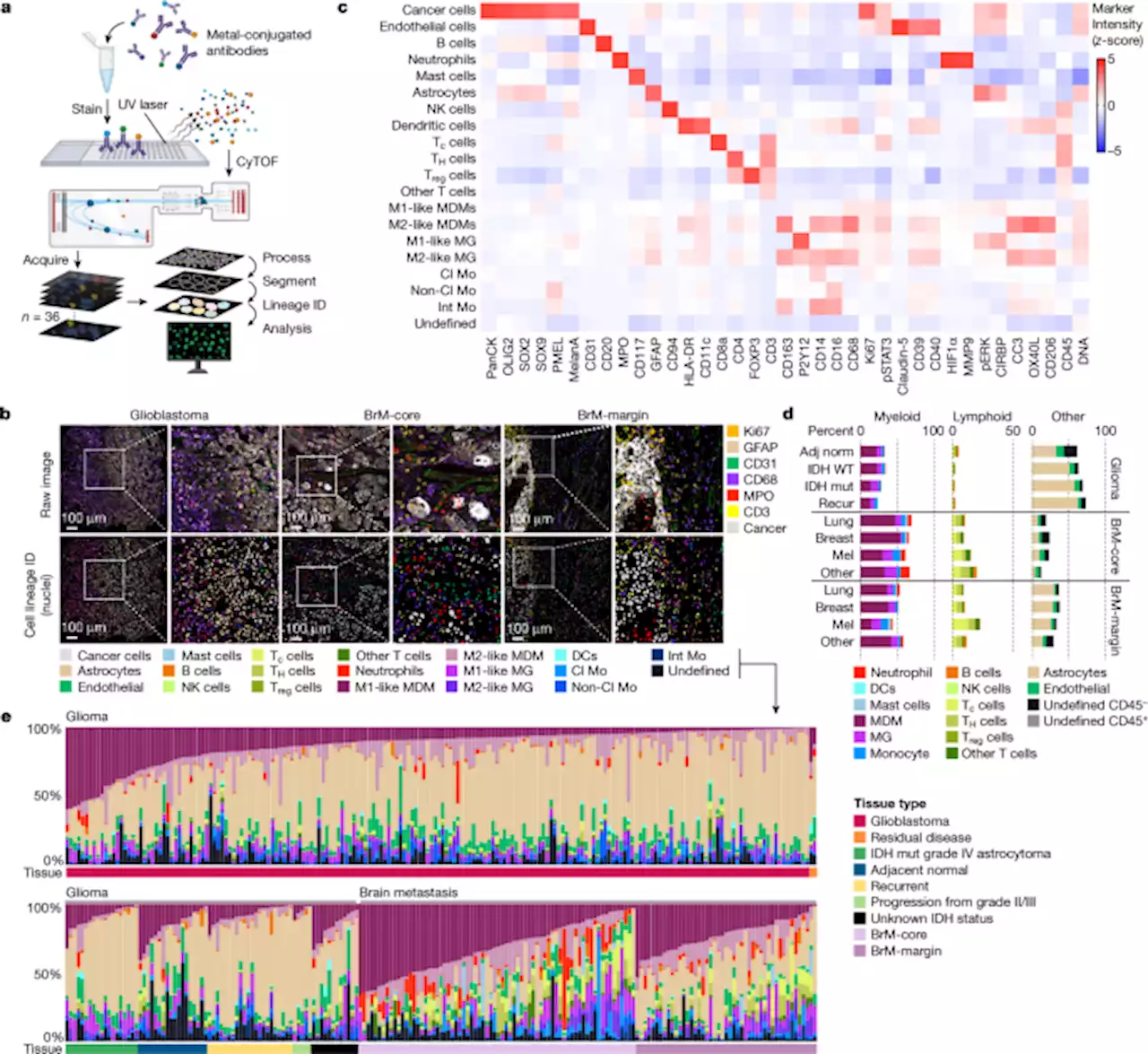 Single-cell spatial immune landscapes of primary and metastatic brain tumours - Nature