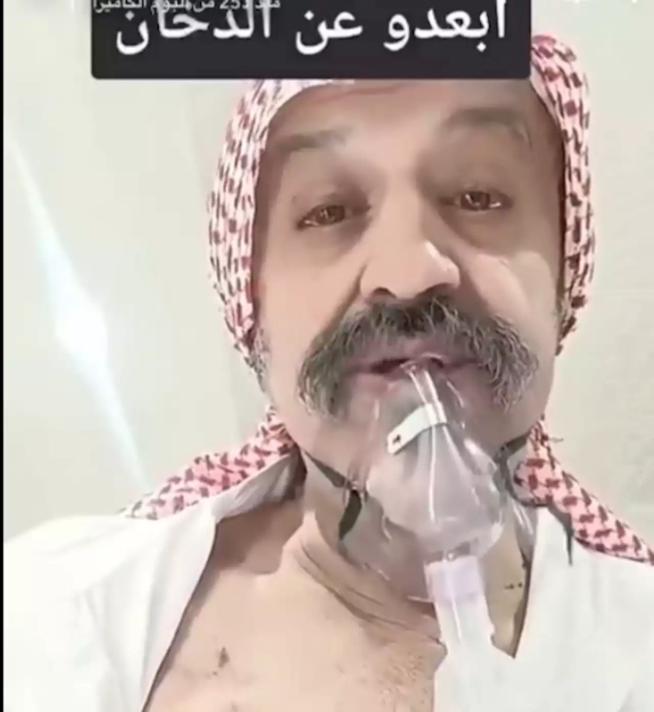 بالفيديو.. مسن يروي معاناته مع التدخين ويكشف عن تركيب 'جهاز إلكتروني' في جسمه -
