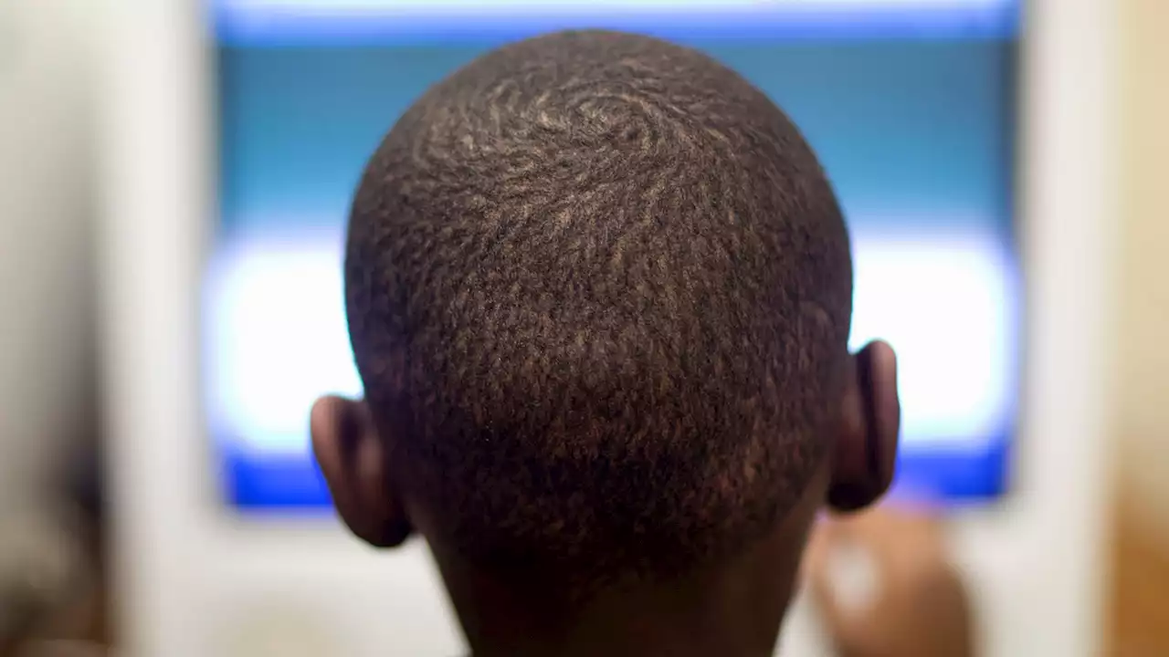 MRIs show stress from poverty, racism may alter brain development of black children, study says