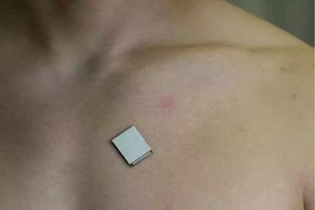 Skin patch makes ultrasound images of your heart as you move