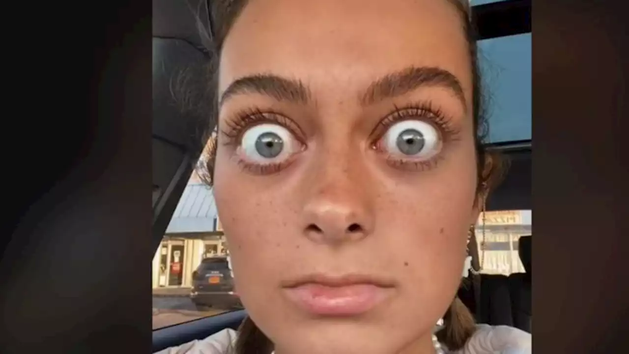 Una joven triunfa en TikTok por sus ojos desorbitados: 'Parece Gollum'