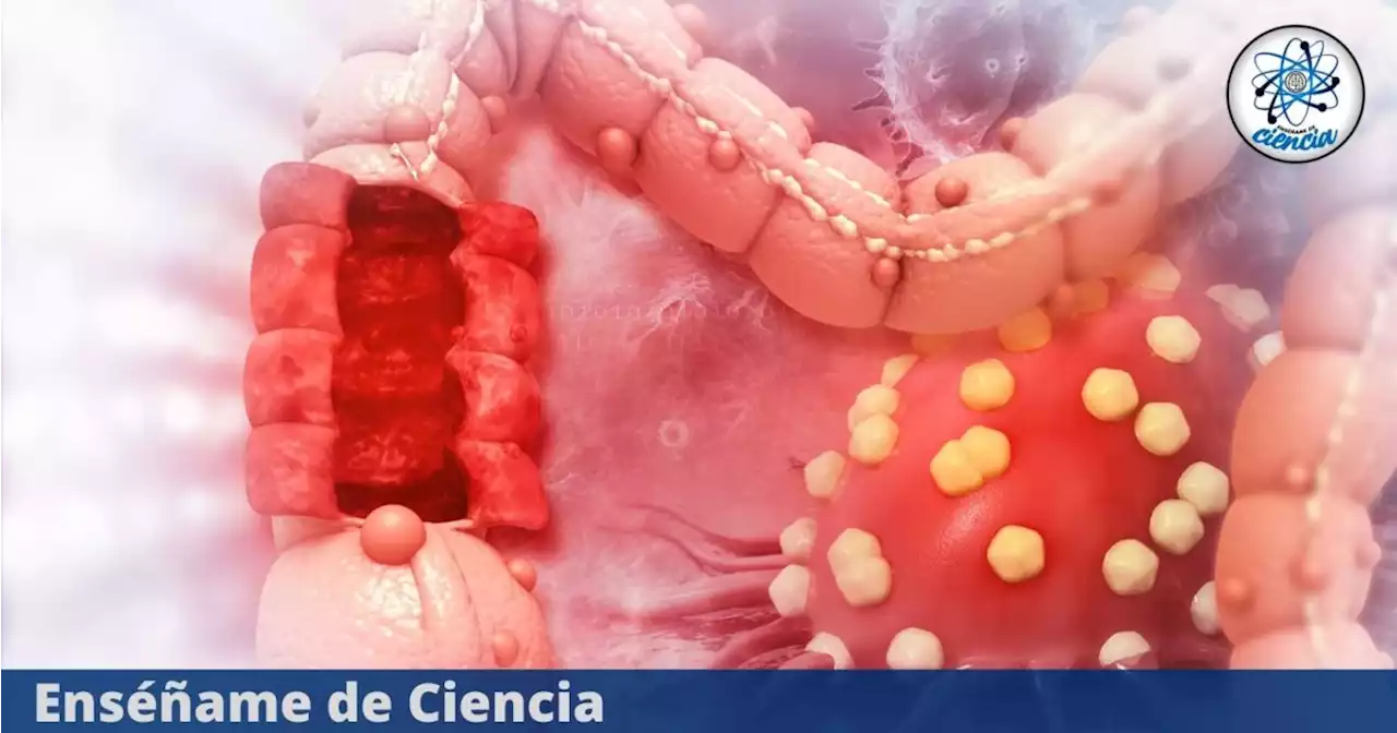 ¿Qué es el cáncer y por qué se produce?