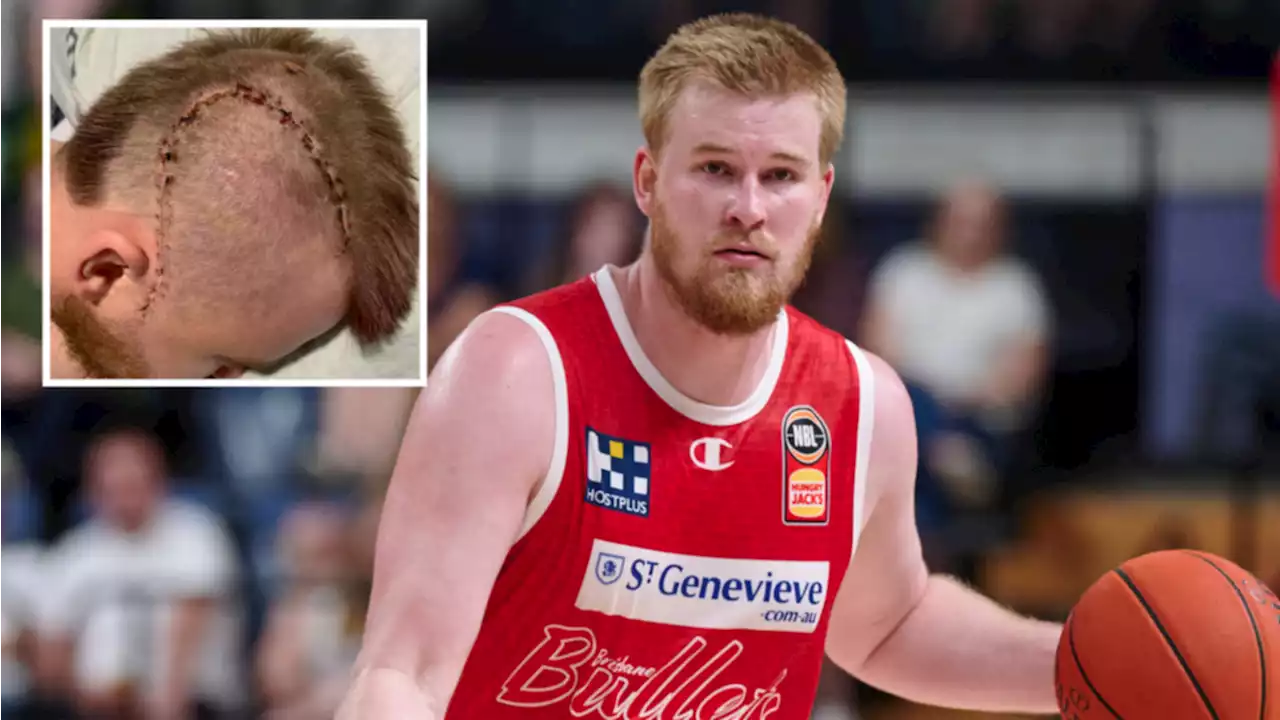 NBL star’s family shares health update after alleged one-punch attack