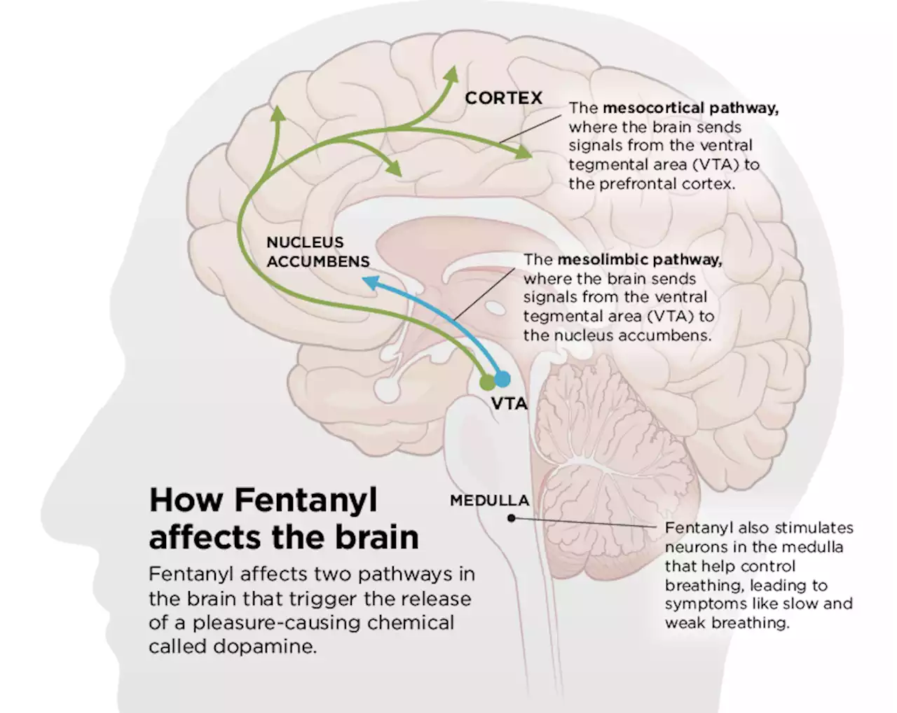 Understanding the effects of fentanyl, the drug fueling an epidemic in North Texas