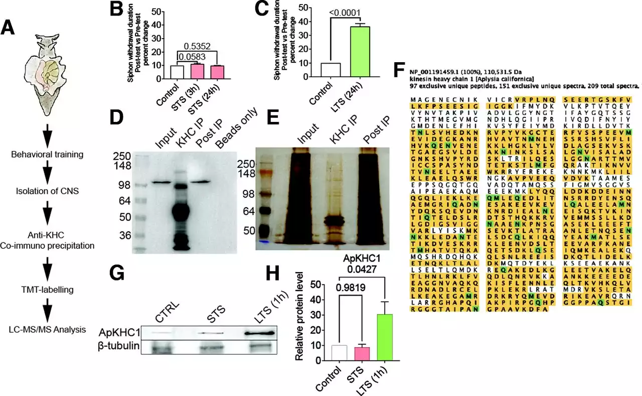 Short-Term and Long-Term Sensitization Differentially Alters the Composition of an Anterograde Transport Complex in Aplysia