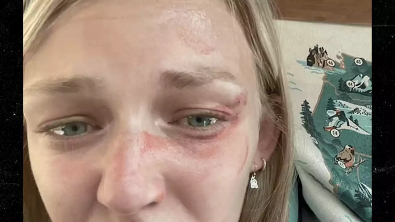 Gabby Petito's Parents Release Selfie Showing Bruised Face Pre-Traffic Stop