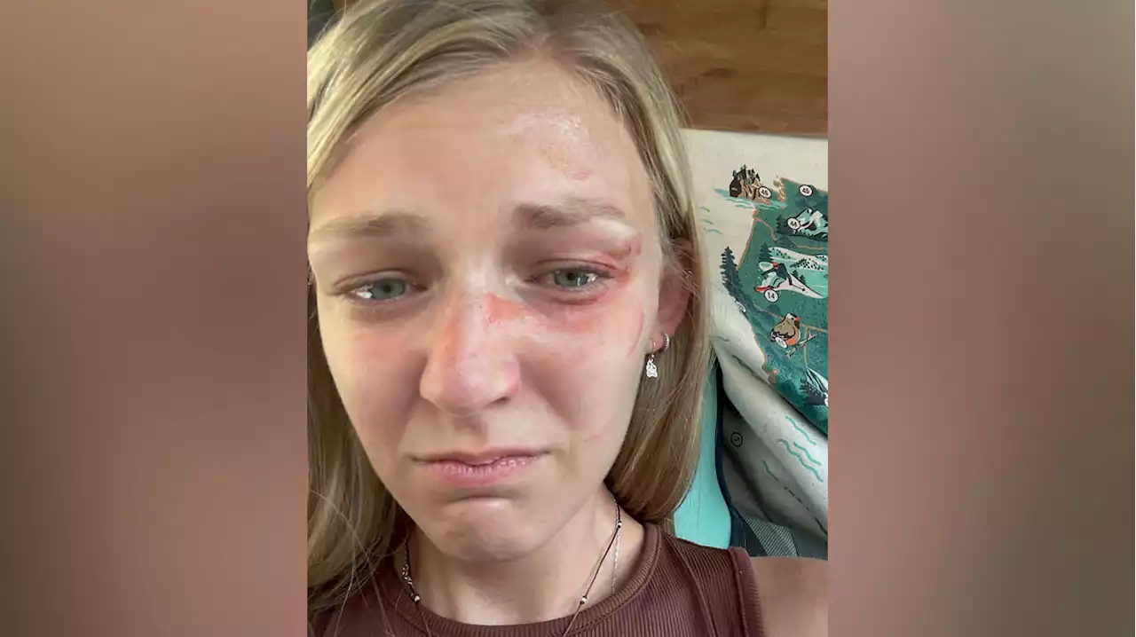 Gabby Petito selfie shows facial injury on day she was interviewed by Moab police, lawyer says