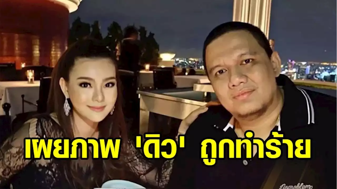 'ไผ่ ลิกค์' โพสต์ภาพ 'ดิว' ถูกทำร้าย แฉโดนป่วนร้าน - เปิดแชท 'เบนซ์' ฝากถาม ต้องทำยังไงให้เรื่องจบ