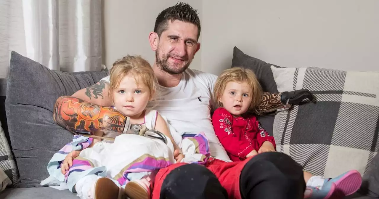 Dad who lost limbs in freak accident is finally able to hold his daughters again