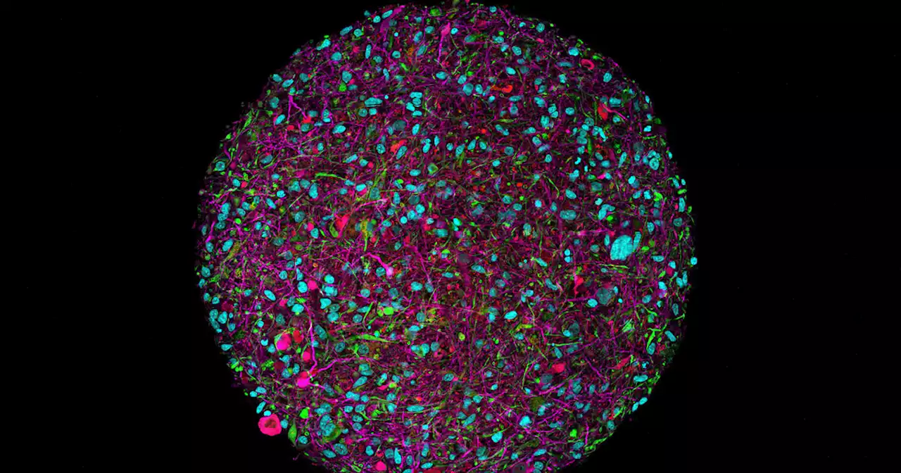 Scientists Working to Build Biocomputers Out of Lab-Grown 'Minibrains'