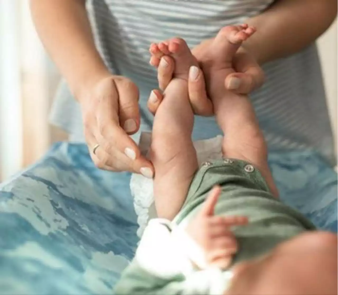 Ini Cara Mengatasi Ruam pada Lipatan Kulit Bayi, Hindari Bedak