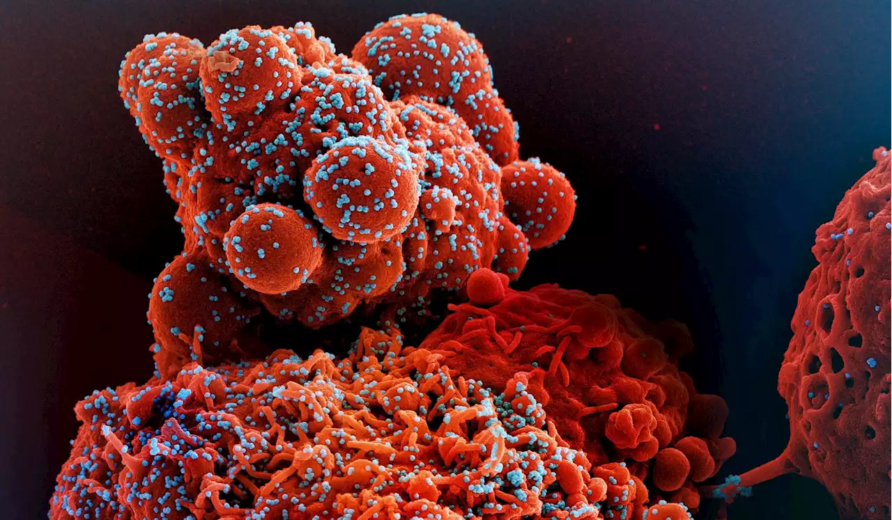 Evidence that cross-reactive immunity from common human coronaviruses can influence response to SARS-CoV-2