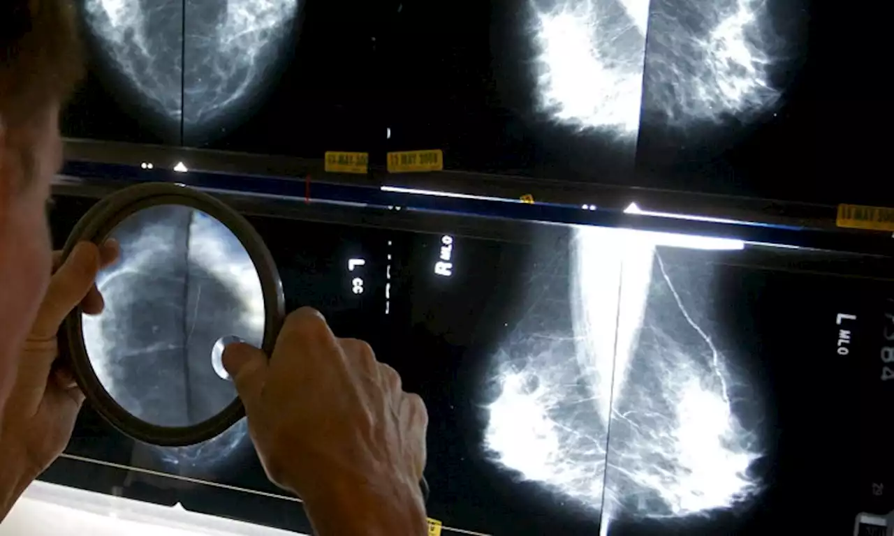 US FDA to require mammogram reports include breast density information