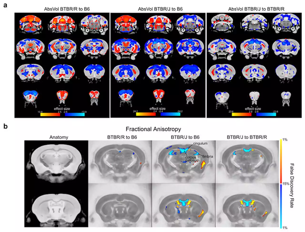 Does an ancient virus genome drive autism?