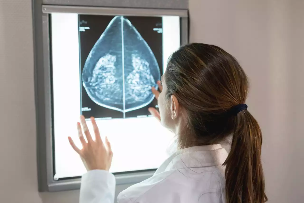 FDA Orders New Mammogram Standards for Women With Dense Breasts