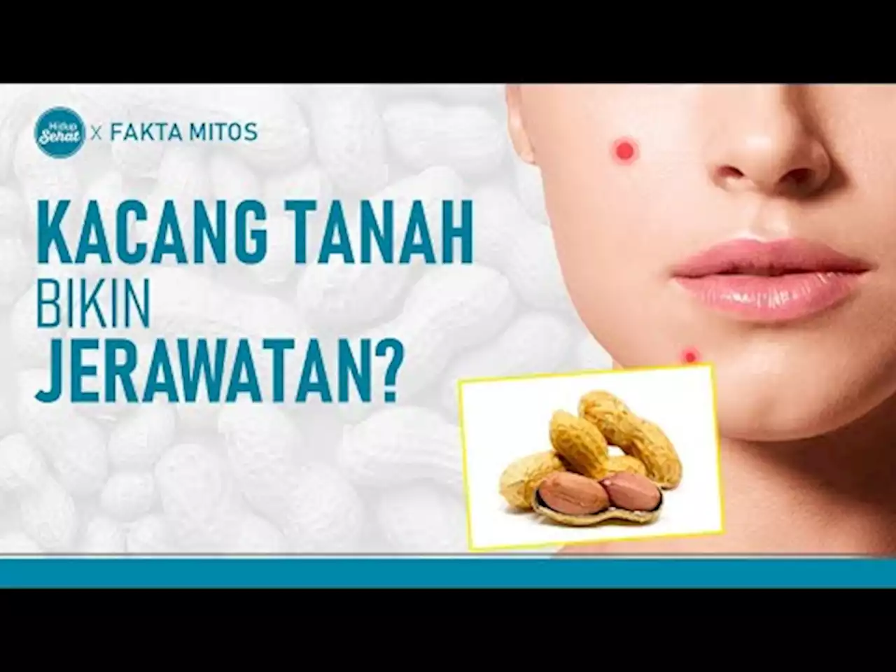 Benarkah Kacang Tanah Bikin Jerawatan? Kenali Fakta Mitosnya - tvOne