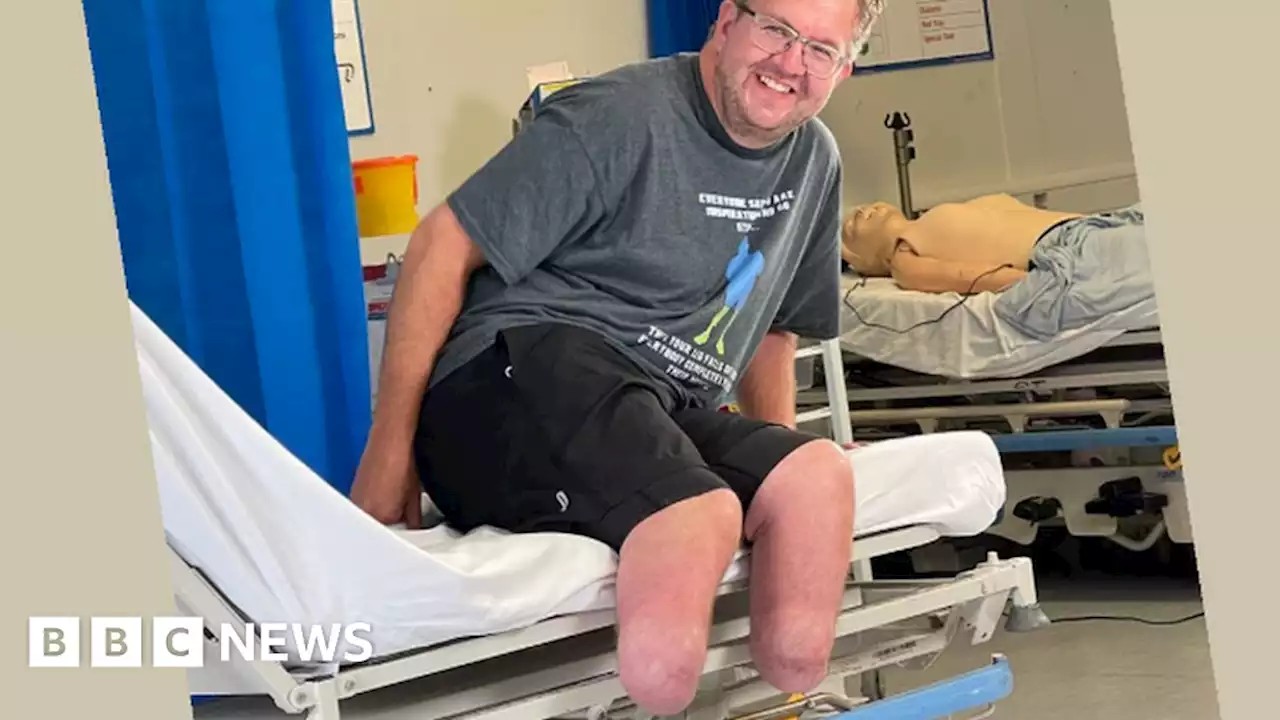 Sepsis: What losing his legs taught surgeon about life