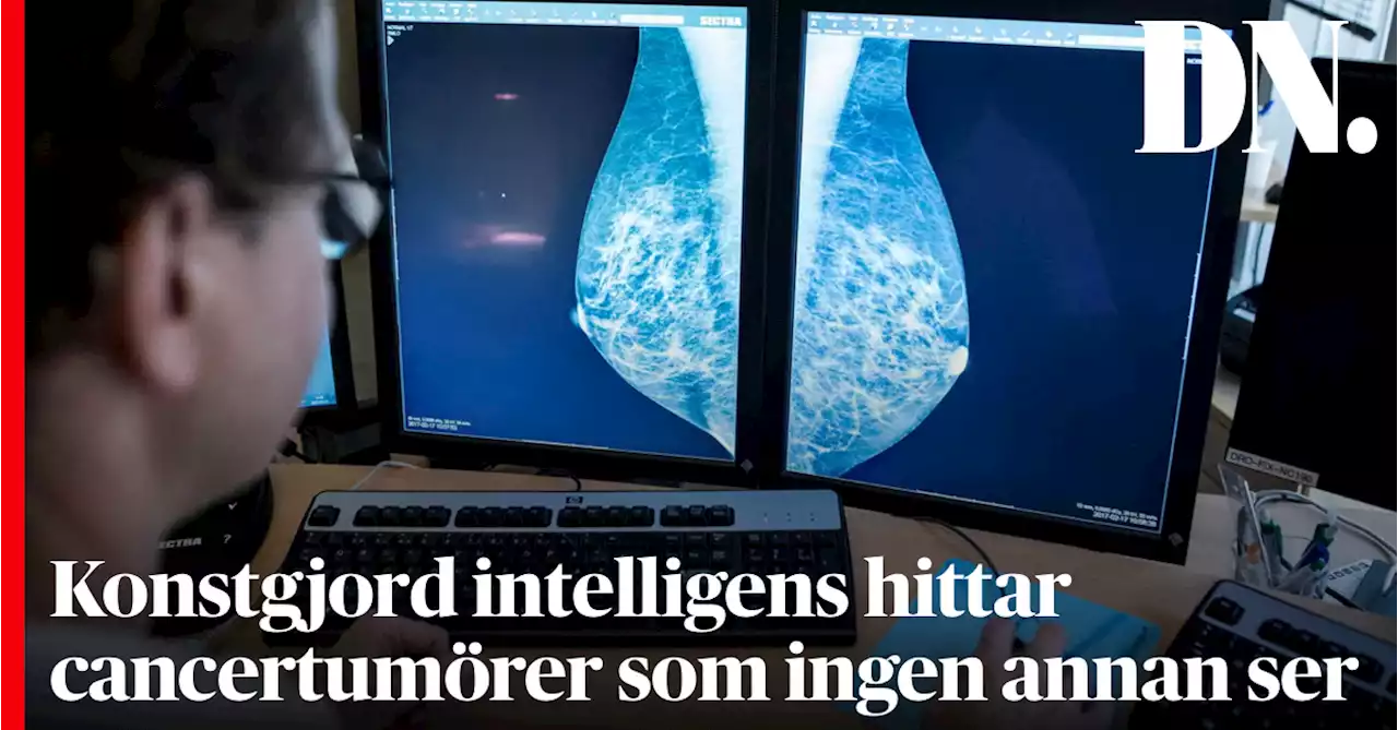 Konstgjord intelligens hittar cancertumörer som ingen annan ser