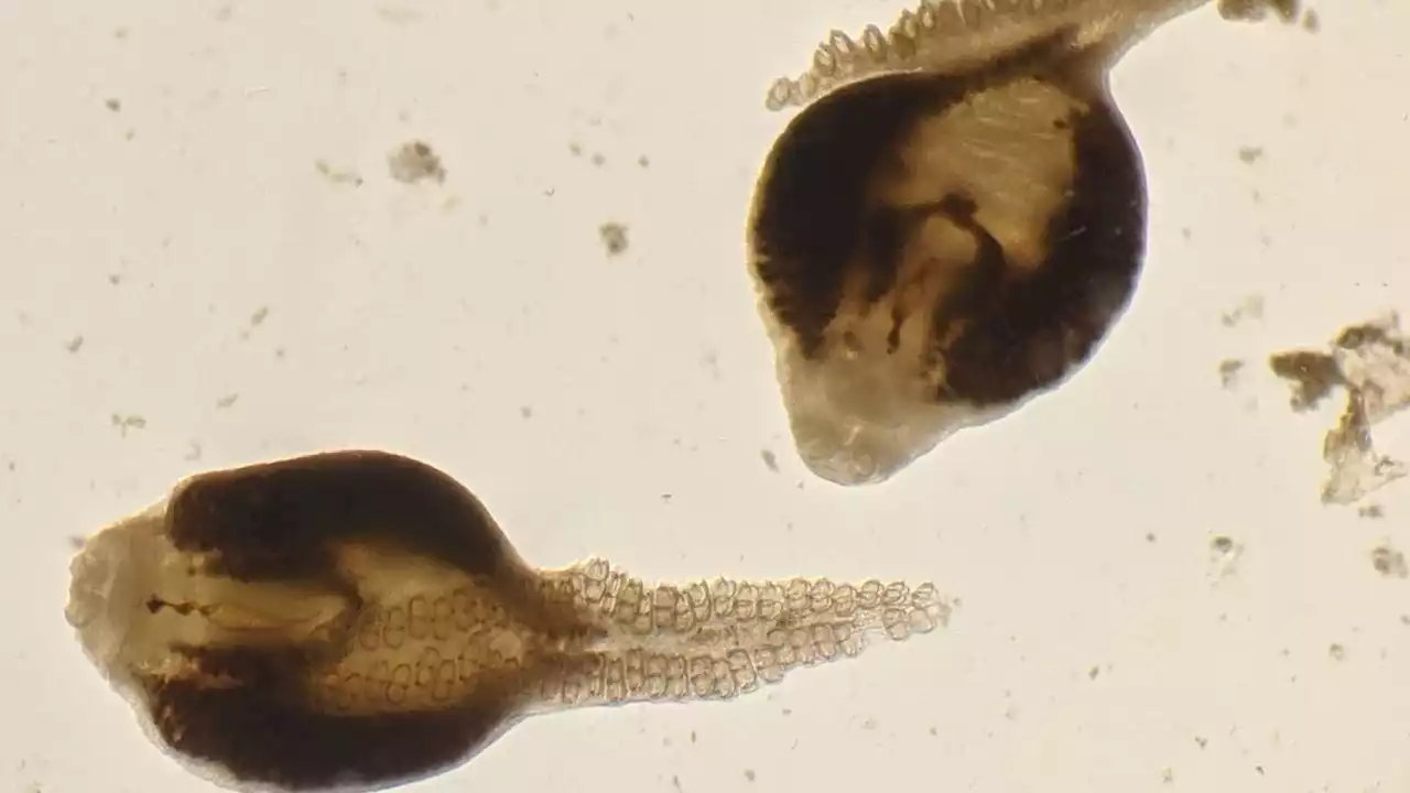 Disappearing parasites in Puget Sound, a bigger concern than you may think