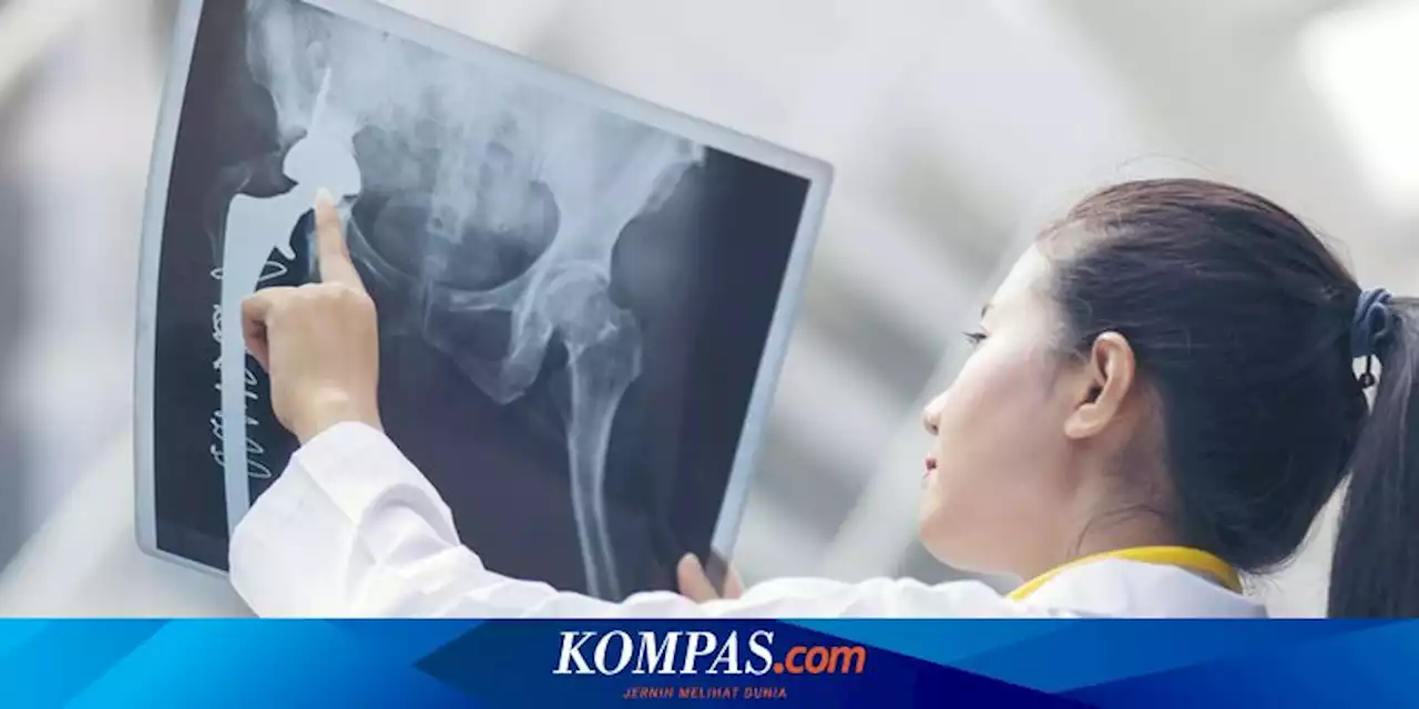 4 Cara Mengobati Kanker Tulang yang Perlu Diketahui