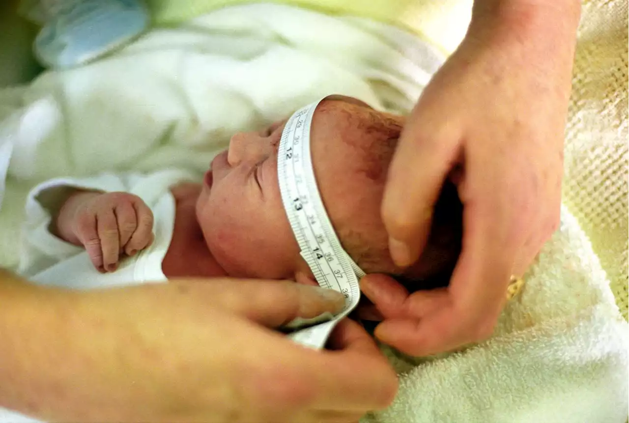 GET-A-HEAD: Midwives agree more awareness needed around baby head circumference measurements