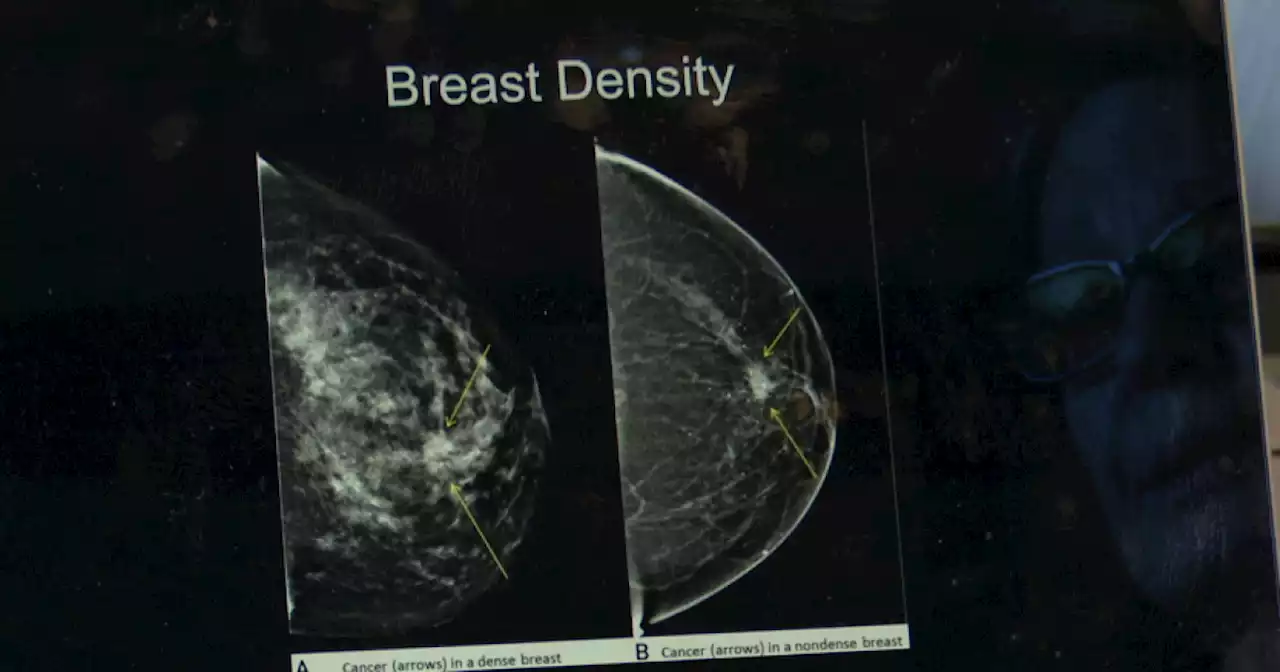 FDA updates mammogram guidelines in hopes to save lives