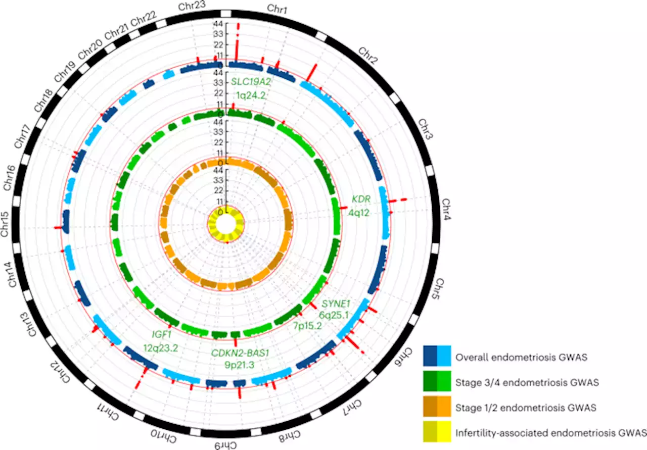 The genetic basis of endometriosis and comorbidity with other pain and inflammatory conditions - Nature Genetics