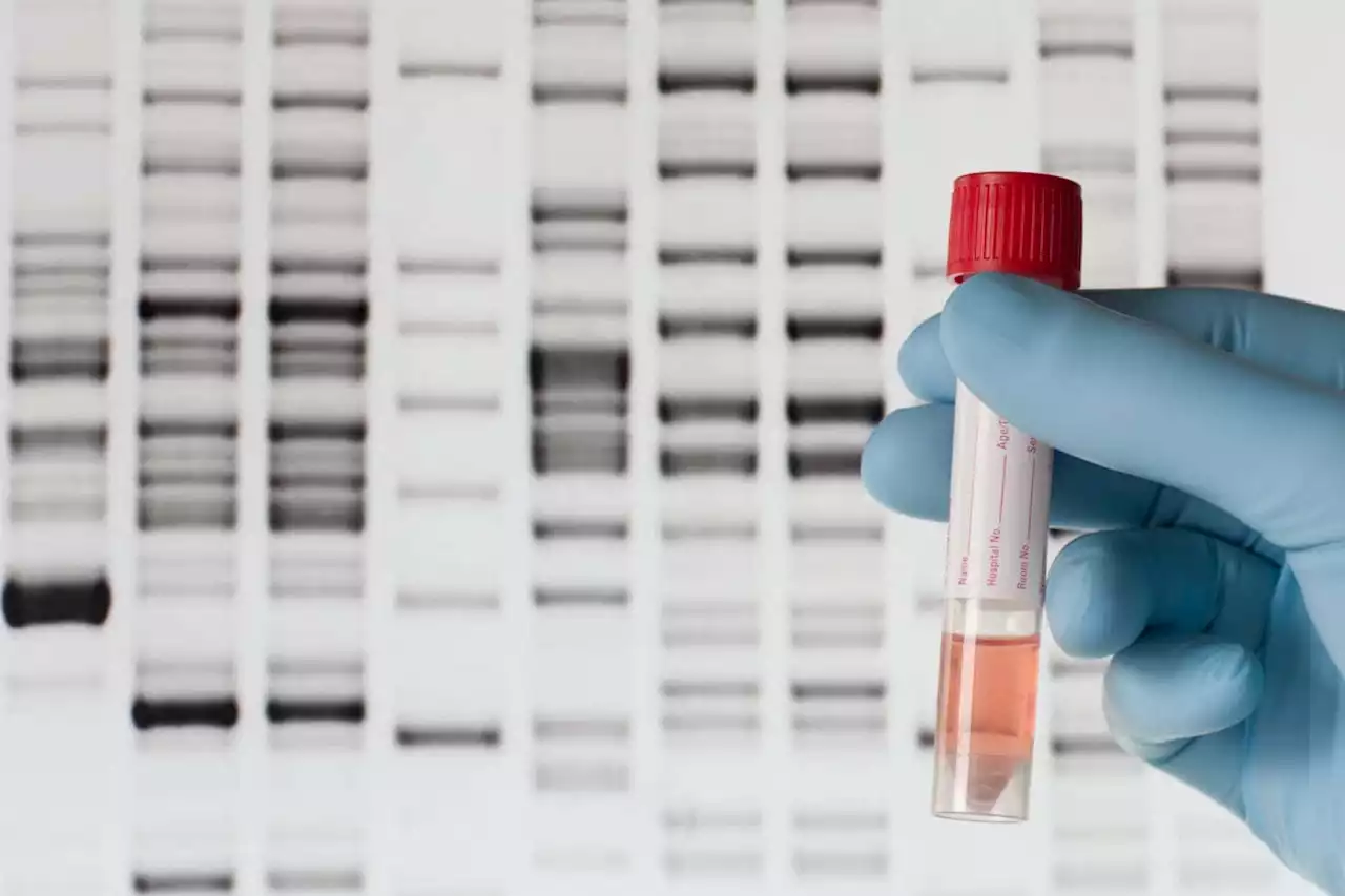 New DNA tests predict your disease risk – are we ready for them?