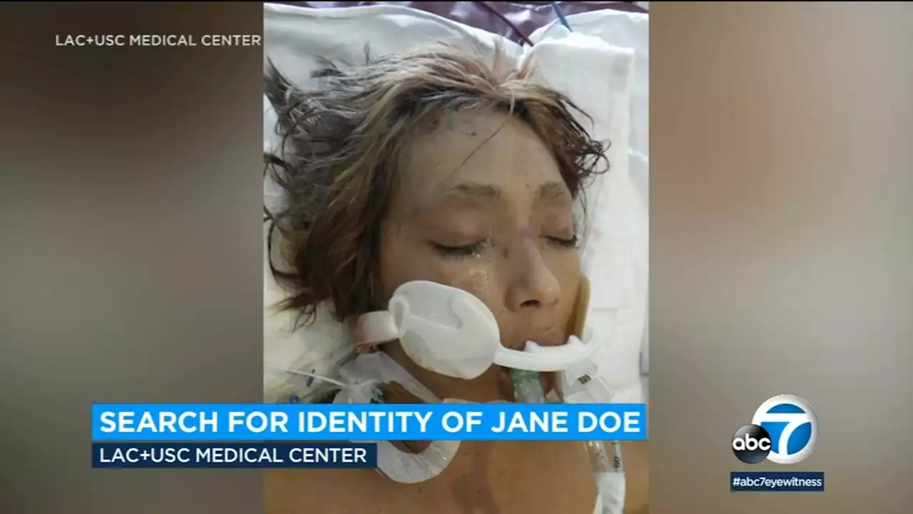 LAC + USC Medical Center needs public's help identifying Jane Doe patient