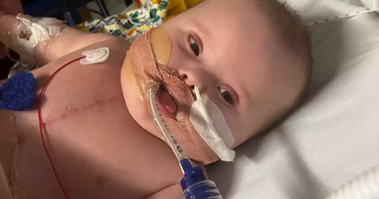 Family 'broken' as baby hit with 4 heart defects, 2 rare conditions and Covid