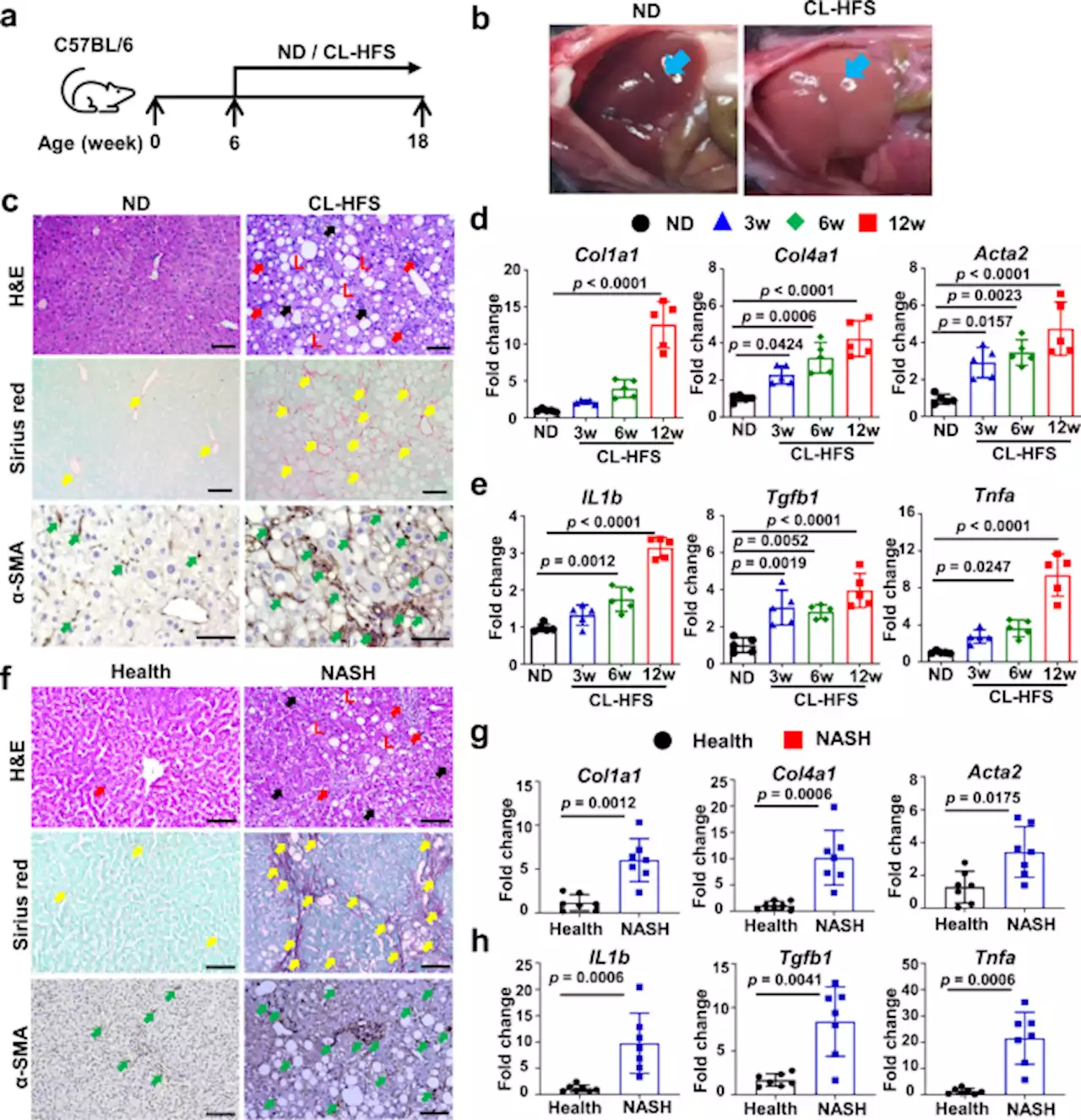 Western diet contributes to the pathogenesis of non-alcoholic steatohepatitis in male mice via remodeling gut microbiota and increasing production of 2-oleoylglycerol - Nature Communications