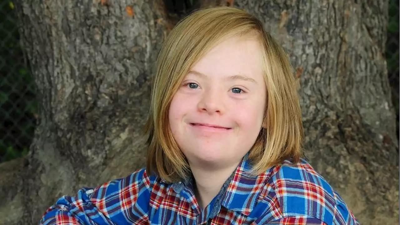 Down syndrome 'doesn't define talent'