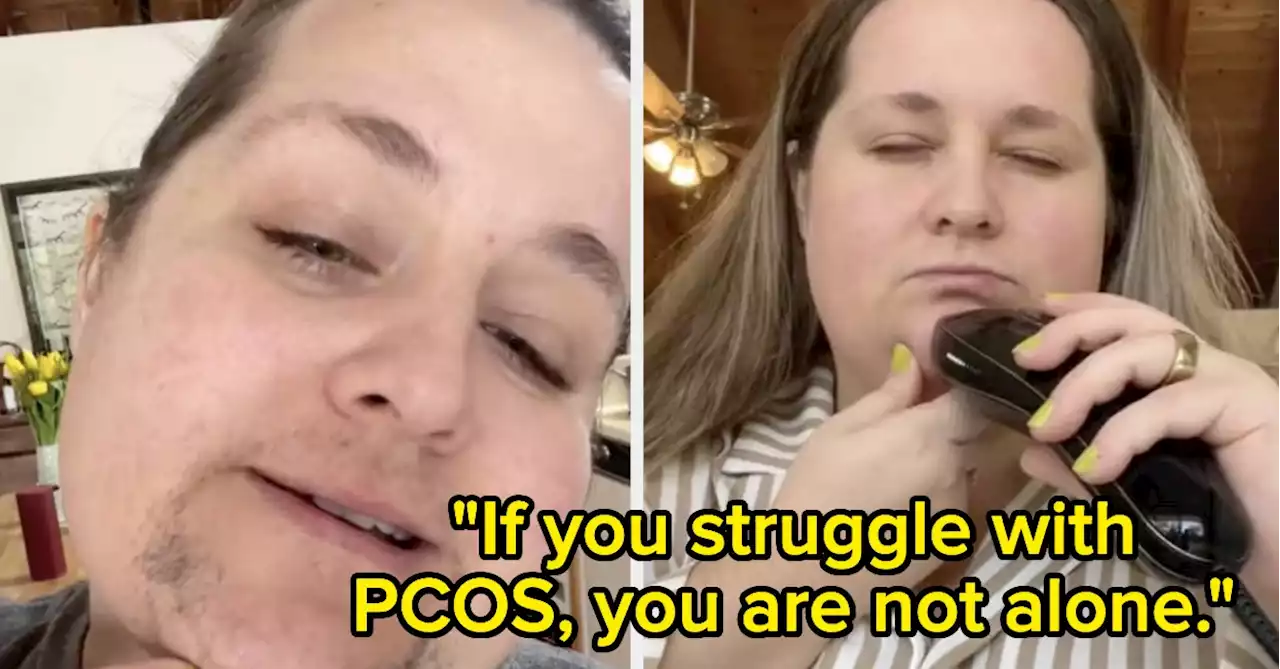 'This Needs To Be Talked About, We Need Representation' — This Woman Went Viral After Sharing Her Experience With Facial Hair From PCOS, And The Conversation Is So Important