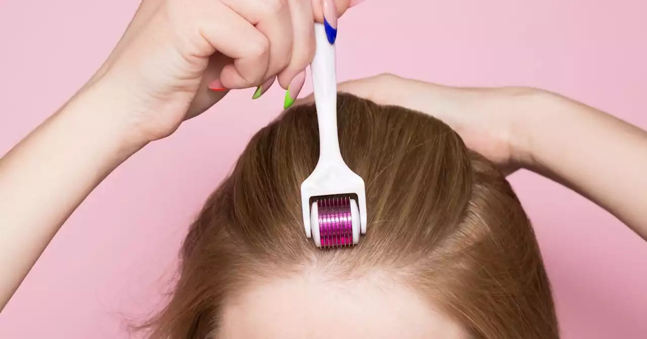 Expert weighs in on TikTok-trending dermarolling for hair growth trend