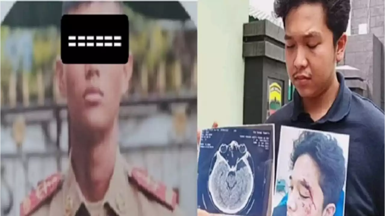 Penganiayaan Mahasiswa oleh Taruna Akmil di Medan Disebut Mirip Kasus Mario Dandy