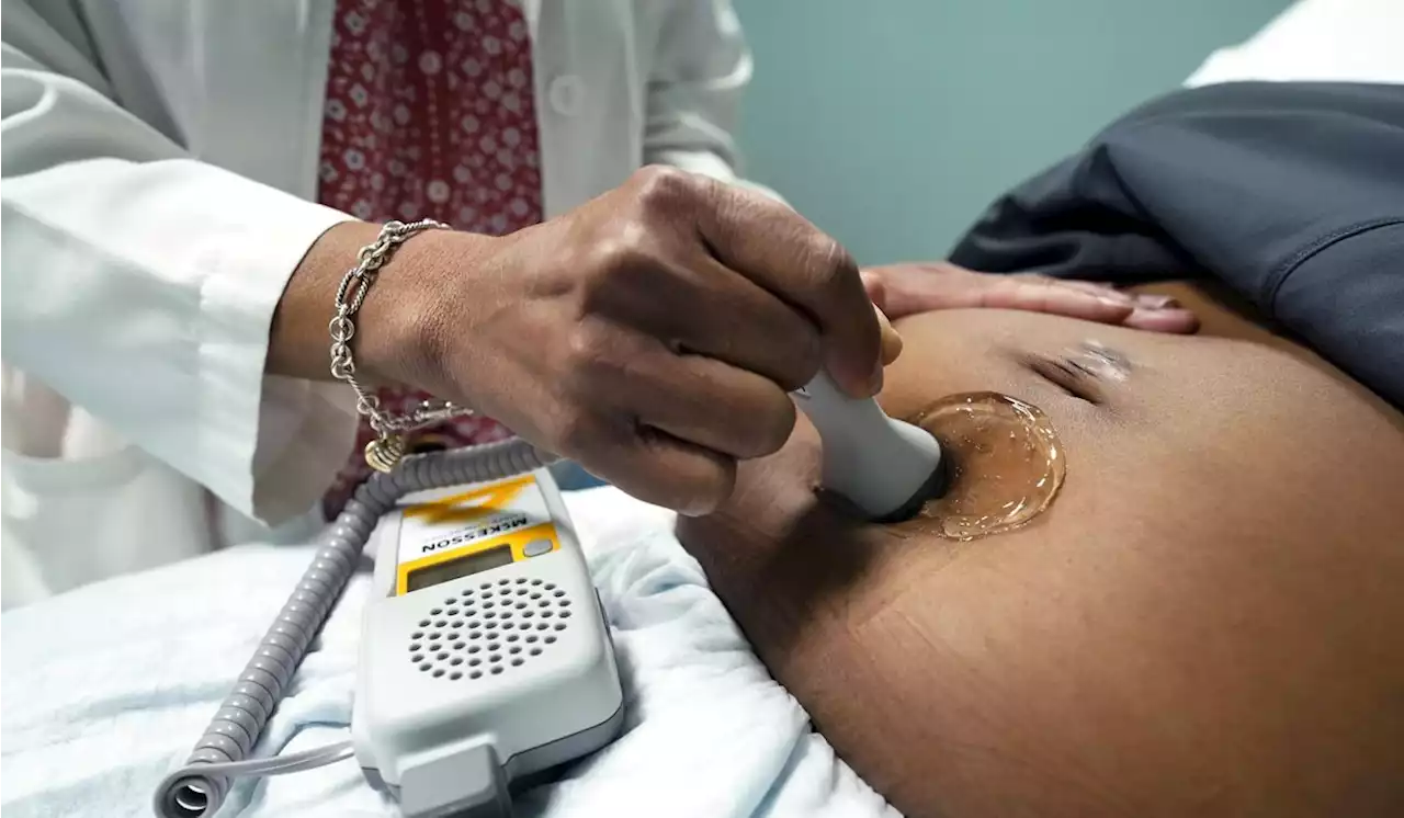 Maternal deaths surged in 2021, CDC says