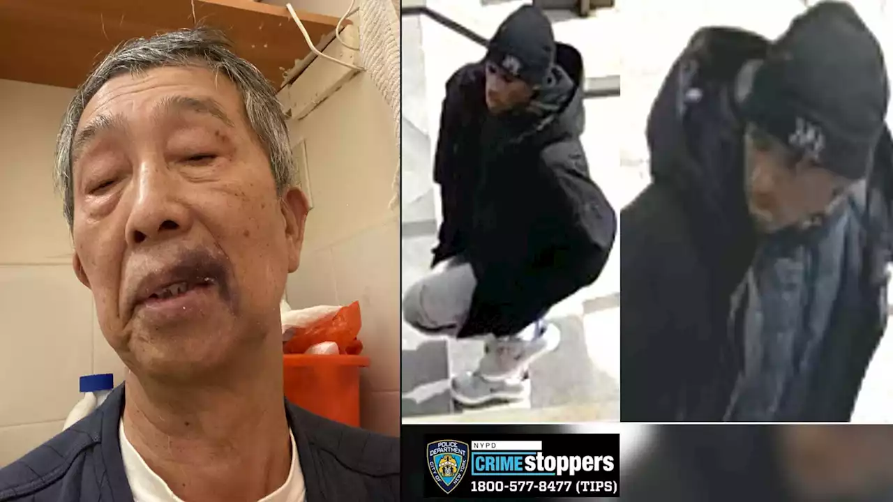 72-year-old man speaks out after random attack on street in Queens