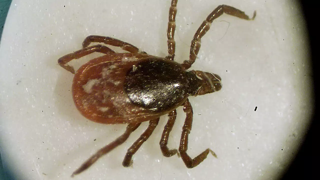 Babesiosis, a tickborne disease, is on the rise in Northeast: CDC report