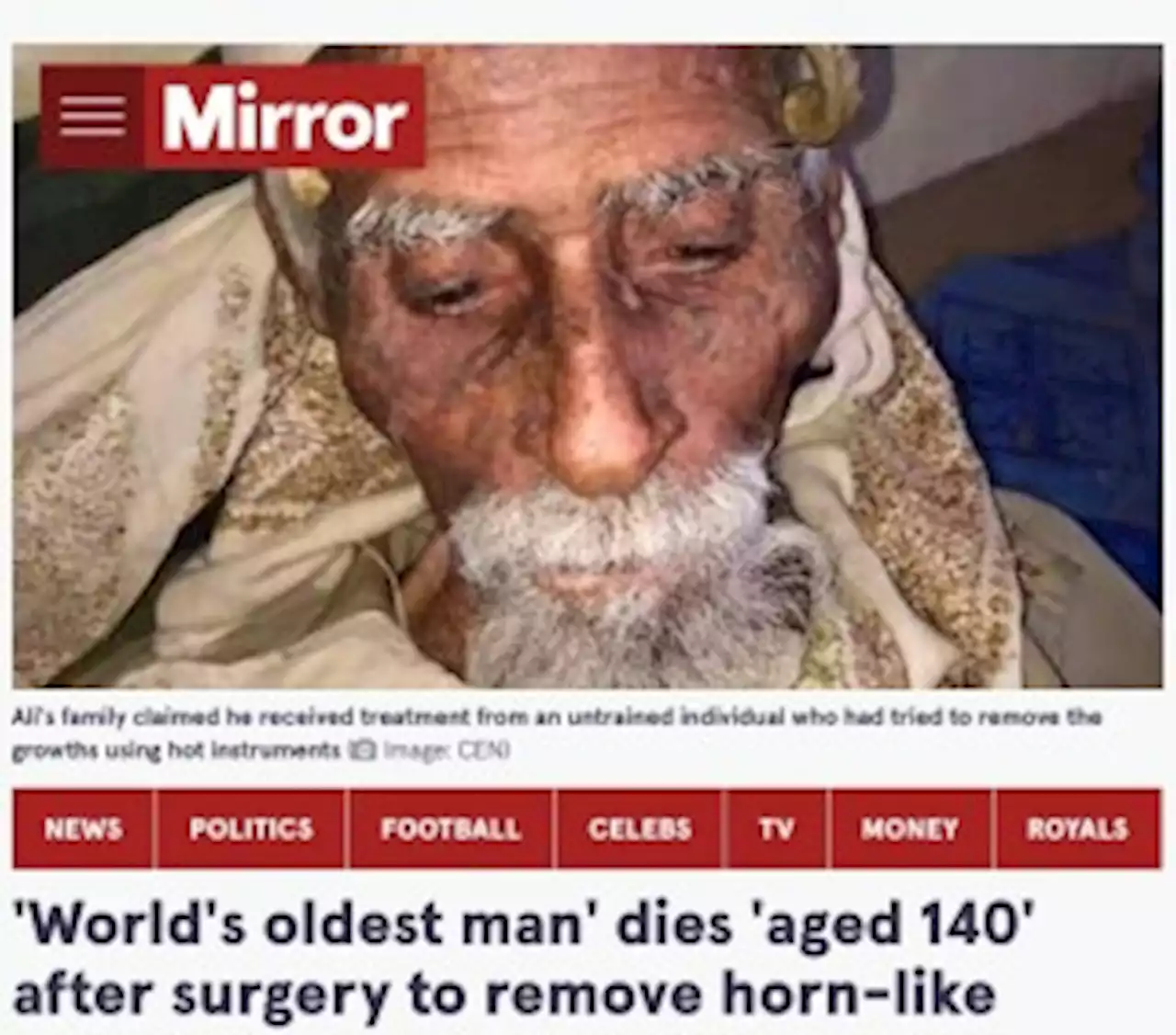 【海外発！Breaking News】「ヒツジ男」と呼ばれた推定140歳の男性、頭の“角”を切除後に死亡（イエメン）＜動画あり＞ - トピックス｜Infoseekニュース